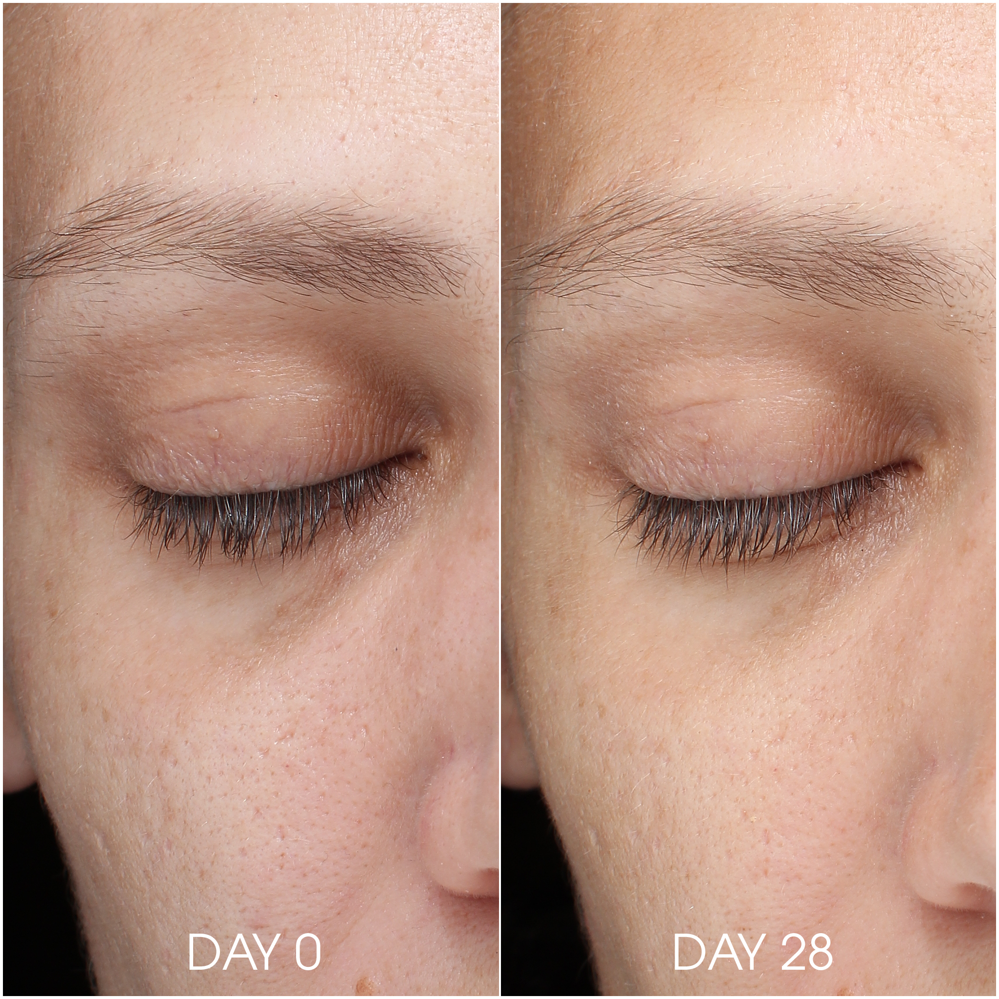 Skin Resilience Routine